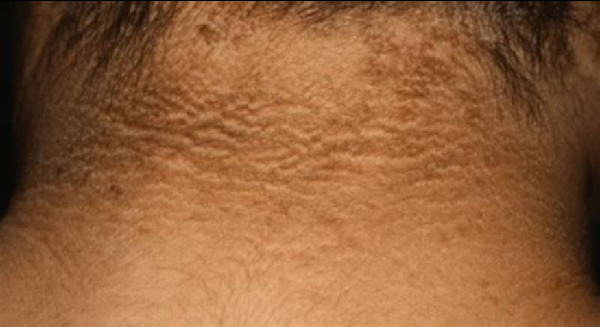 사진=커뮤니티 캡처 1000019971.jpg